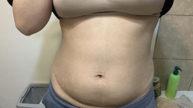 How can I lose this fat?