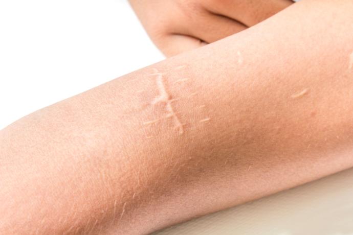 Do you have any scars?