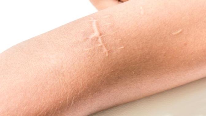 Do you have any scars?