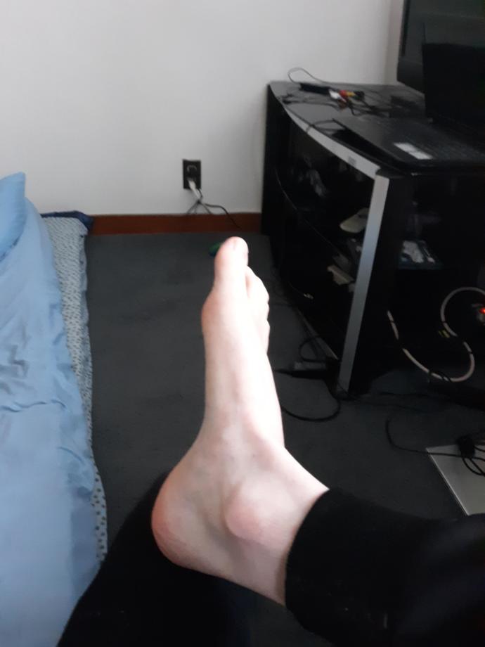 Are you self conscious about your feet?