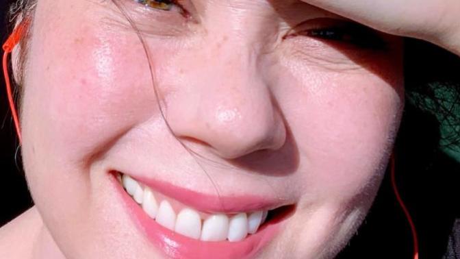 Do guys like girls with red pasty skin?