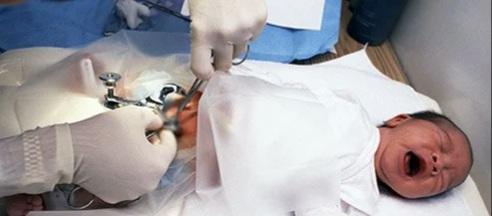 Who do you think should have the right to wheather circumcise their son, the mom or dad?