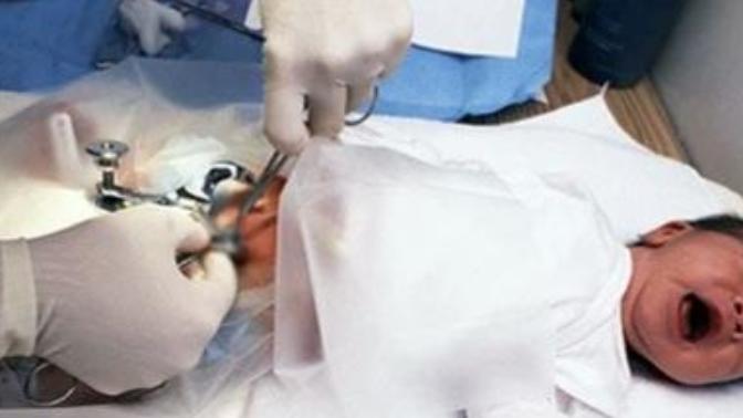 Who do you think should have the right to wheather circumcise their son, the mom or dad?