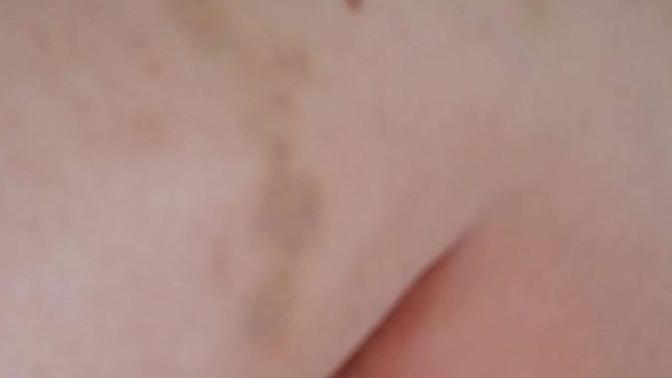 Beat up in front of my girl - a week later and what's next?