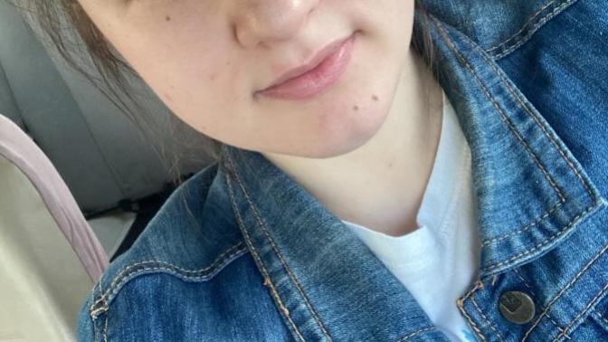 I feel like the beauty marks and I started to get Acne is ruining my face even more?