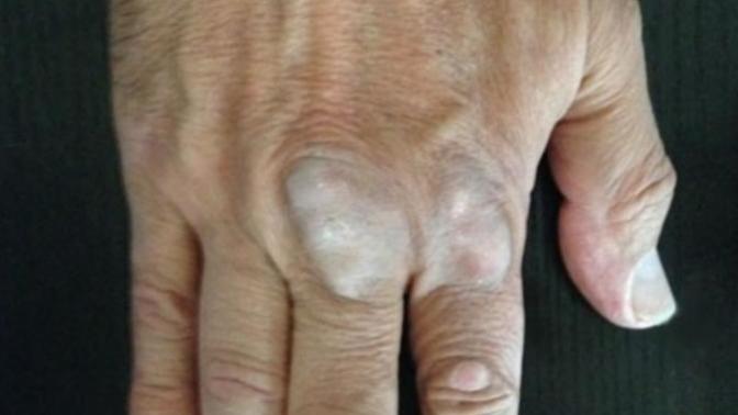 Can you imagine having knuckles like this and thinking "this is totally fine"?