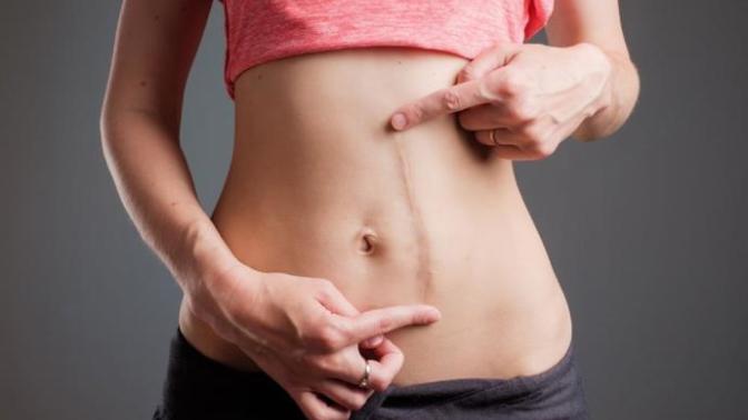 Do you have any scars? How’d you get them?