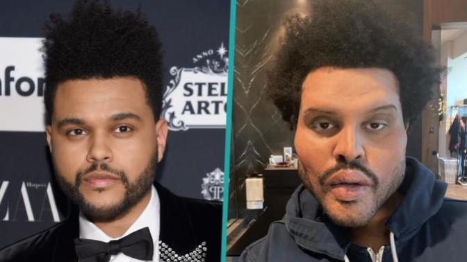 How do you feel about his "plastic surgery"?