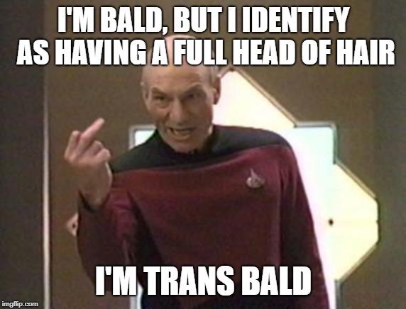 Does male balding bother you?