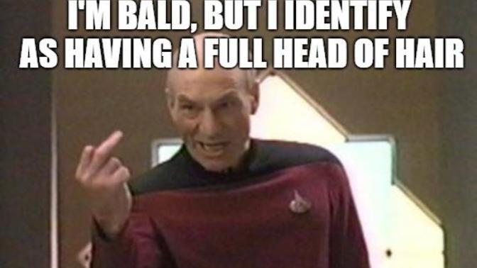 Does male balding bother you?
