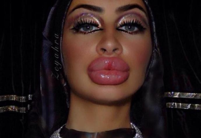 Do girls really think the fake lips trend is attractive?