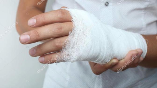 Is breaking someone's hand for stealing an excessive punishment?