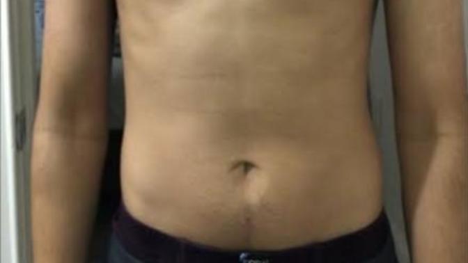 What type of chest do you find attractive and appealing on men?