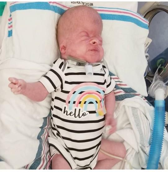 What are your thoughts on parents who decide to keep their severely special needs child who is mentally at a vegetative state?