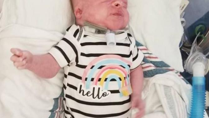 What are your thoughts on parents who decide to keep their severely special needs child who is mentally at a vegetative state?