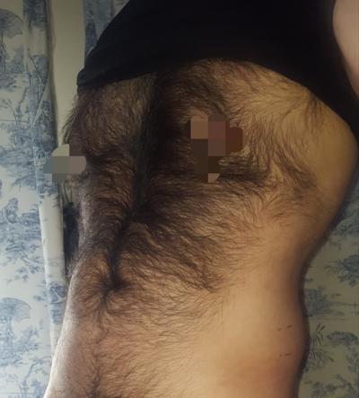 Girls, If you were a male and had lots of body hair?