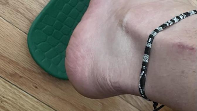 Does wearing an ankle bracelet give off gay vibes?