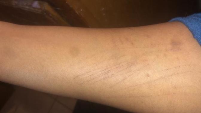 Is this okay to tattoo over?