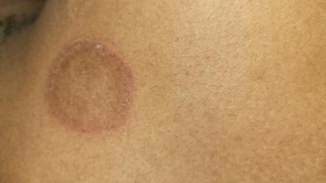 What is this mysterious scar?
