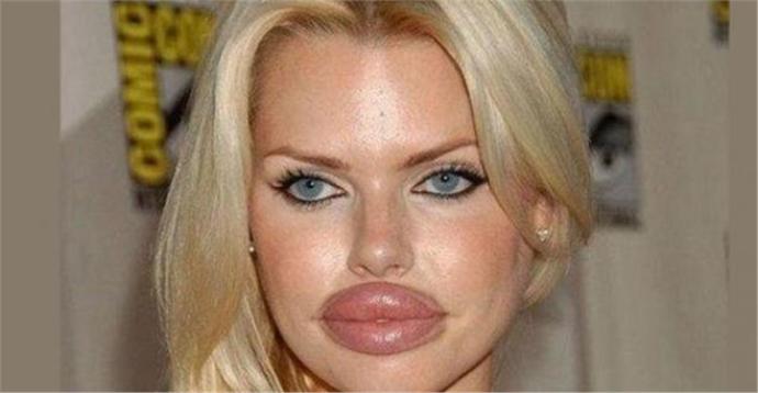 My boyfriend doesn't want me to have lip fillers. Is this controlling behavior?