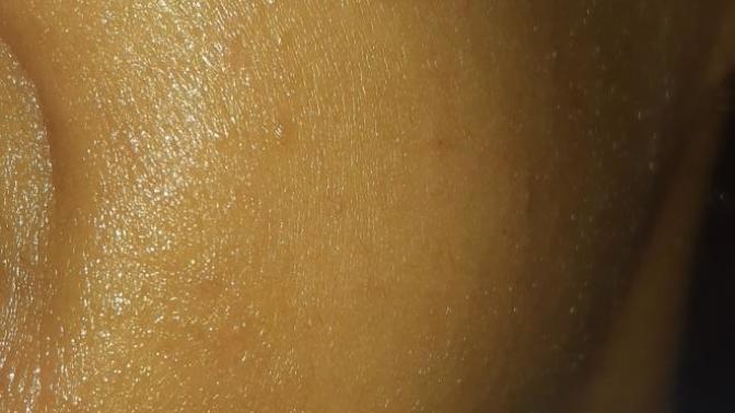 Do these look like wrinkles?