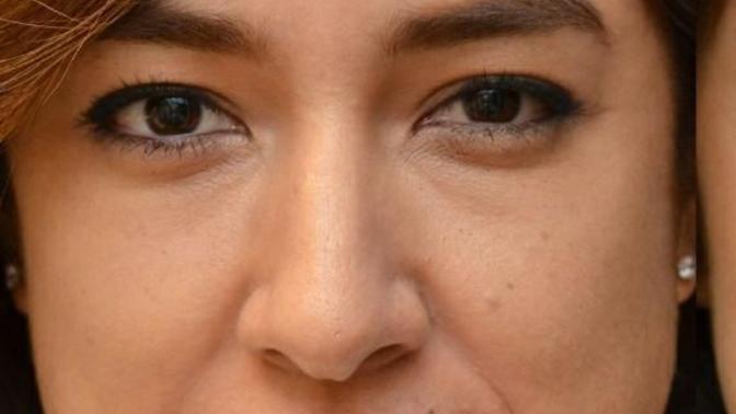 Guys, is it s turn off when a woman has visible smile lines?