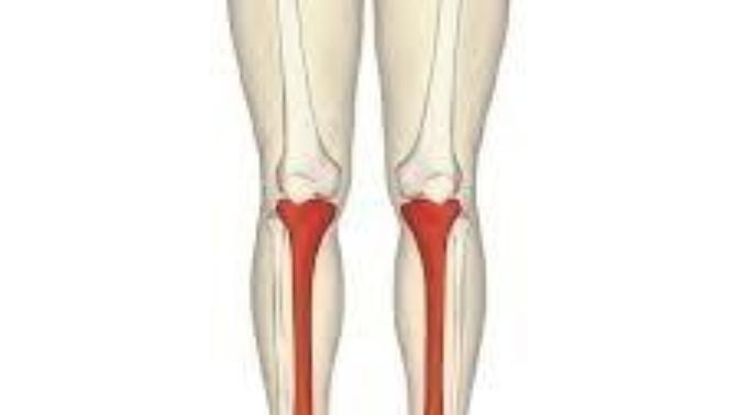 If you feel along your shin bone do you feel bumps from running into things your whole life?
