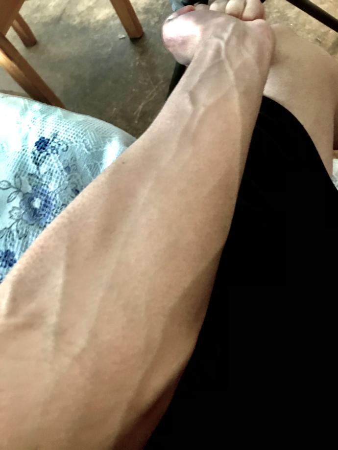 Are visible veins attractive, gross or nothing?