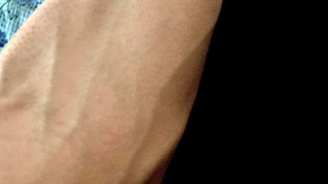 Are visible veins attractive, gross or nothing?