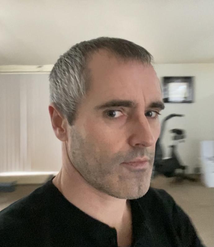 Which is best on me, bald spot and thinning hair or shaved (keep in mind the poll pic with hair has bald spot in back!)?