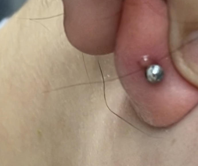 What is this on my lobe piercing?