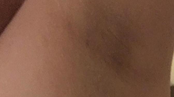 Guys, is a girl having dark pigmented underarms a turn off for you?