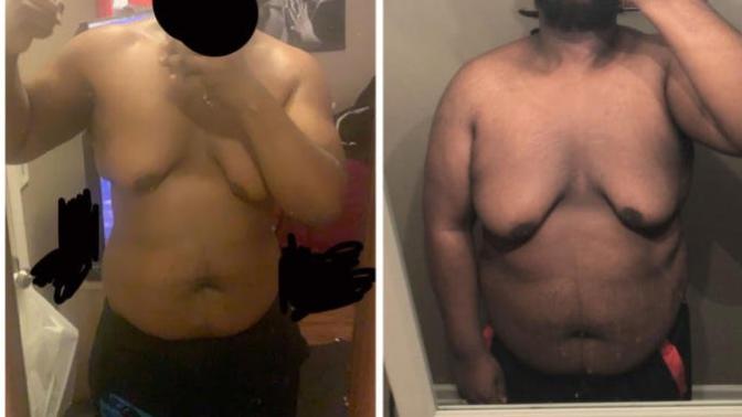 Why can’t I lose this stubborn chest fat?