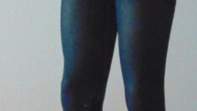 I have to wear compression stockings against circulation problems. Girls would that be a problem to date guy like that?