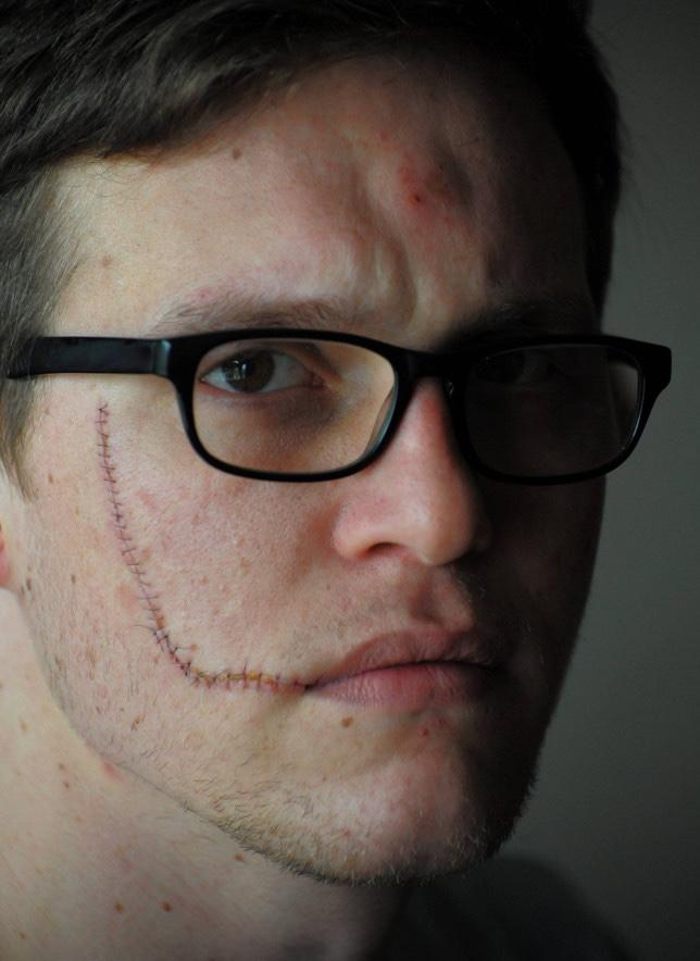 Do facial scars make men more attractive?