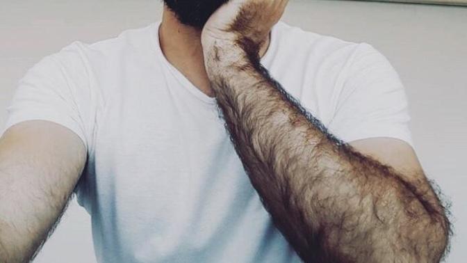 Are men with hairy arms a dealbreaker?