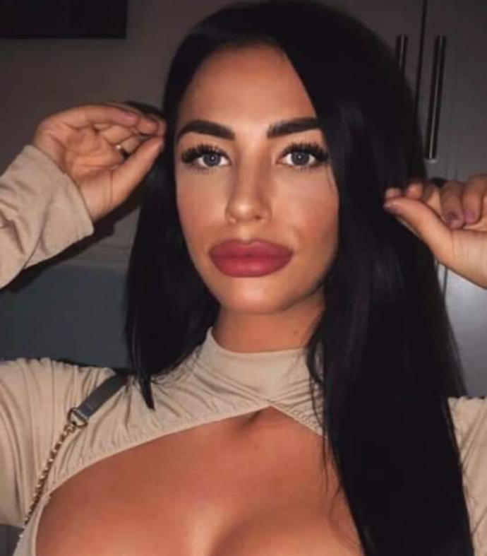 Are you a fan of the lip filler look or prefer more natural?