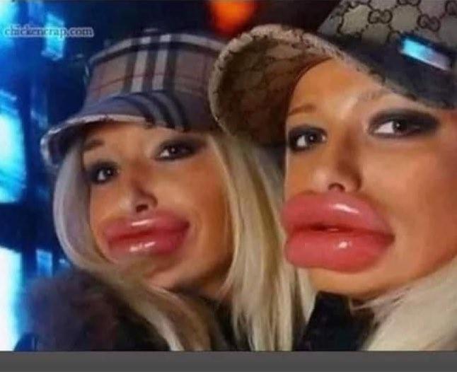 Are you a fan of the lip filler look or prefer more natural?