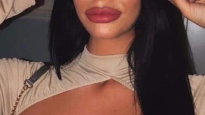 Are you a fan of the lip filler look or prefer more natural?