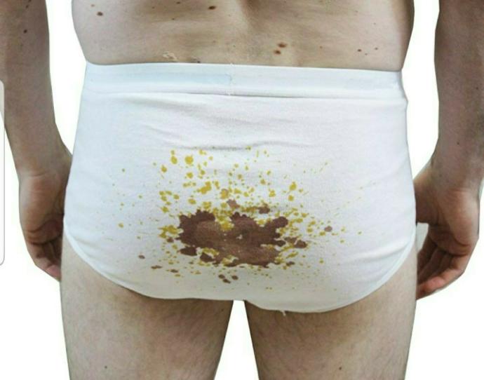 Are white briefs (tighty whities) unattractive or unsexy?