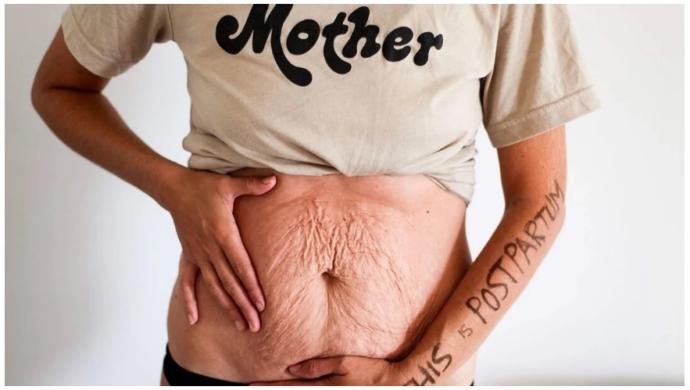 Do You Have a Problem with a Womans Postpartum Body?