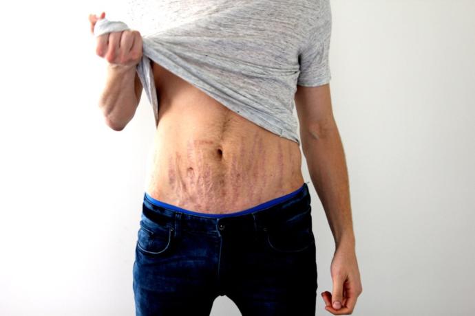 Do You Have a Problem with a Woman's Postpartum Body?