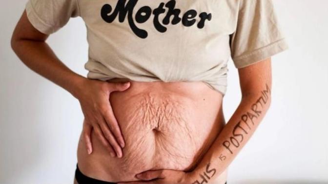 Do You Have a Problem with a Woman's Postpartum Body?