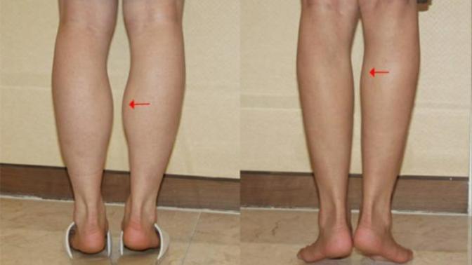 Men, are you more attracted to women with small calves? Are thick calves a turn off?