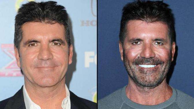 Do you think plastic surgery makes someone less attractive than ever?