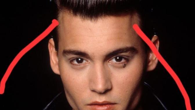 What are these ridges on the side of forehead called?