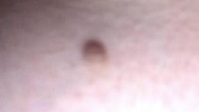 What are these things on my skin?
