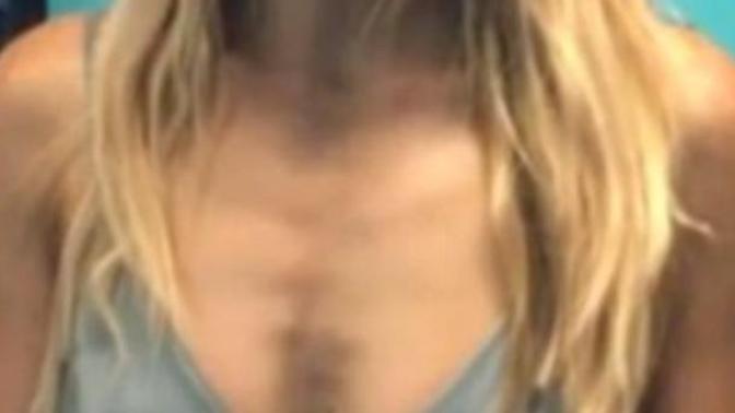 Is it bad that my ribs have become visible like this?