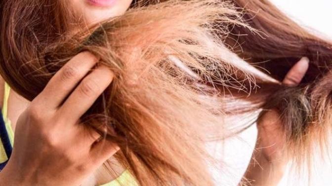Does anyone else have a problem with dry hair? Any tips?