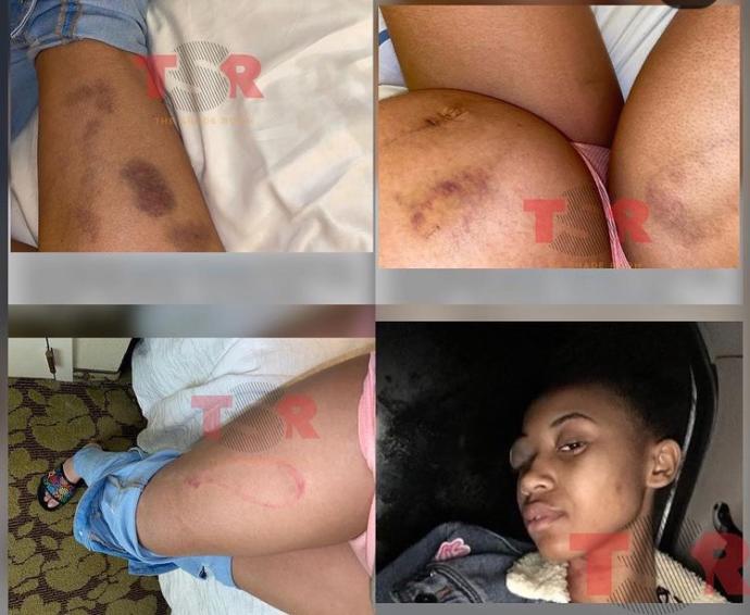 Man beats woman pregnant with his child, has beaten her multiple times, still isn’t in jail. Why do men abuse women they’re in relationships with?